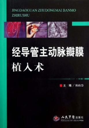 经导管主动脉瓣膜植入术 封面