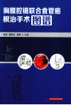 胸腹腔镜联合食管癌根治手术图谱 封面