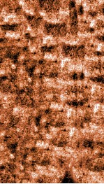 痘疹正宗 上 封面