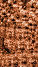 痘疹正宗 中 封面