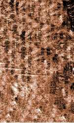 痘疹定论 卷3-4 封面