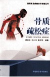 骨质疏松症 封面