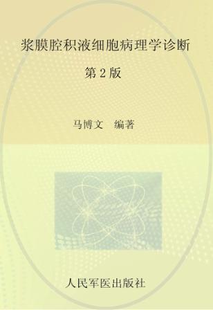 浆膜腔积液细胞病理学诊断