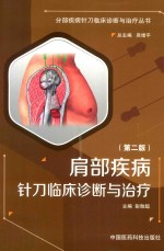 肩部疾病针刀临床诊断与治疗 封面