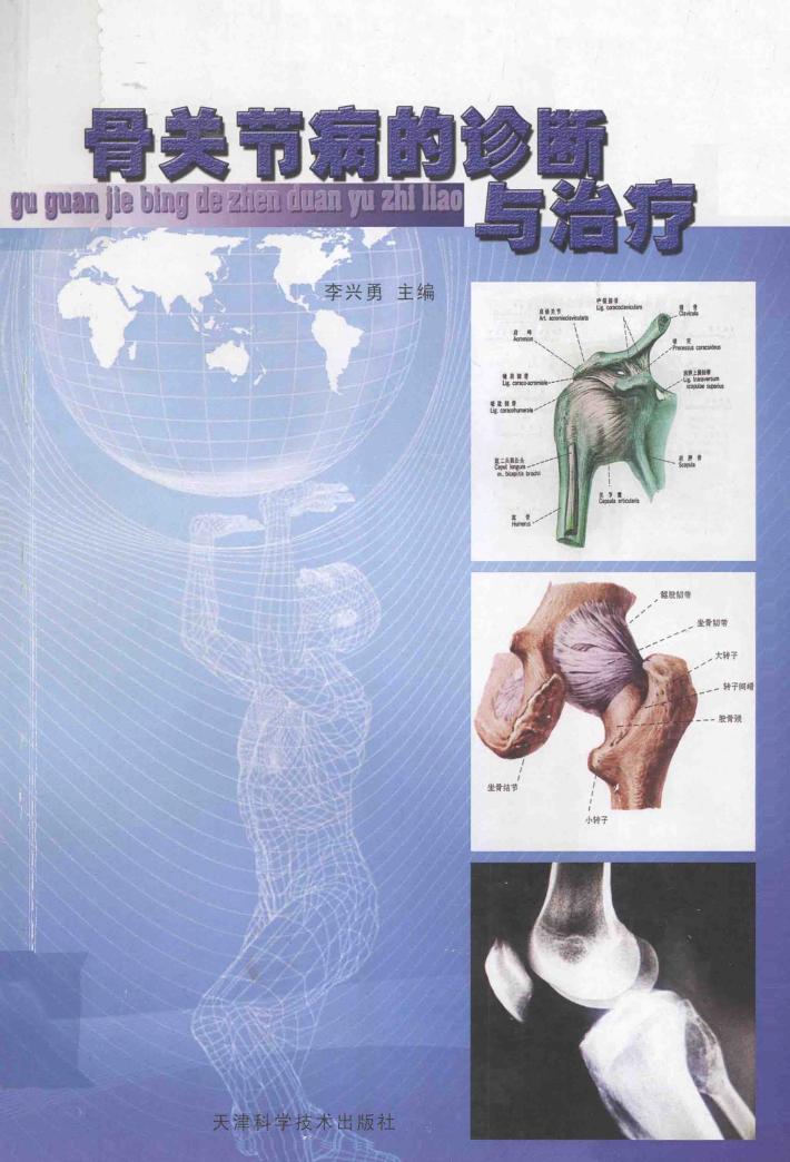 骨关节病的诊断与治疗 封面