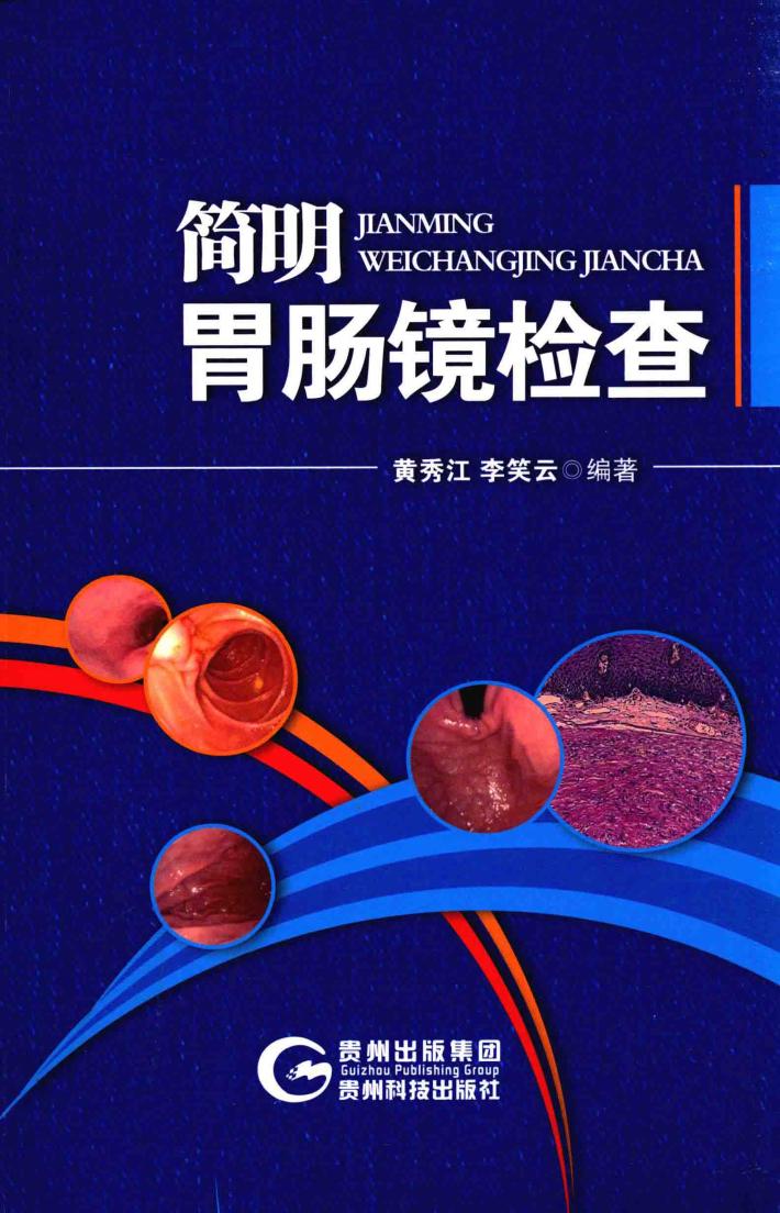 简明胃肠镜检查 封面