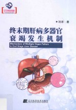终末期肝病多器官衰竭发生机制 封面