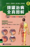 拔罐治病全真图解 封面