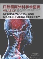 口腔颌面外科手术图解 封面