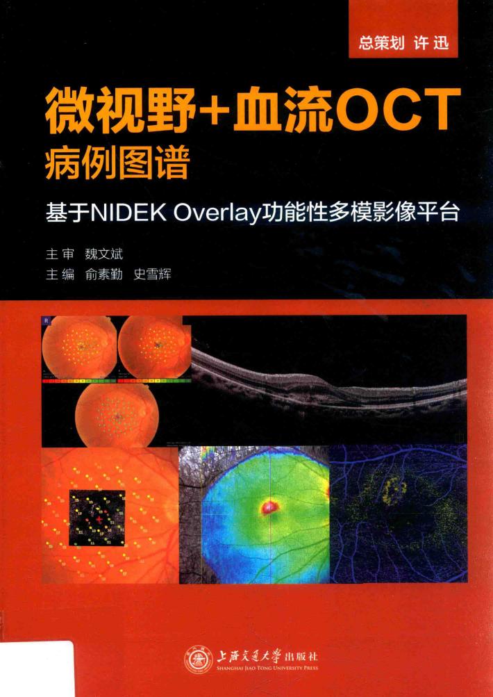 微视野+血流OCT病例图谱 基于NIDEK Overlay功能性多模影像平台 封面