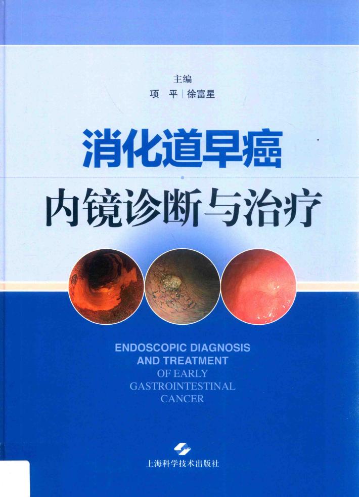 消化道早癌内镜诊断与治疗 封面