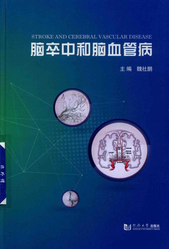 脑卒中和脑血管病 封面