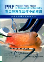 PRF在口腔再生治疗中的应用  生物学背景和临床适应证 封面