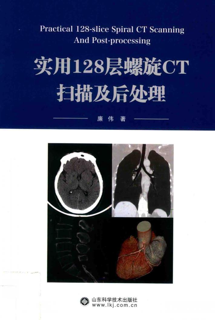 实用128层螺旋CT扫描及后处理 封面