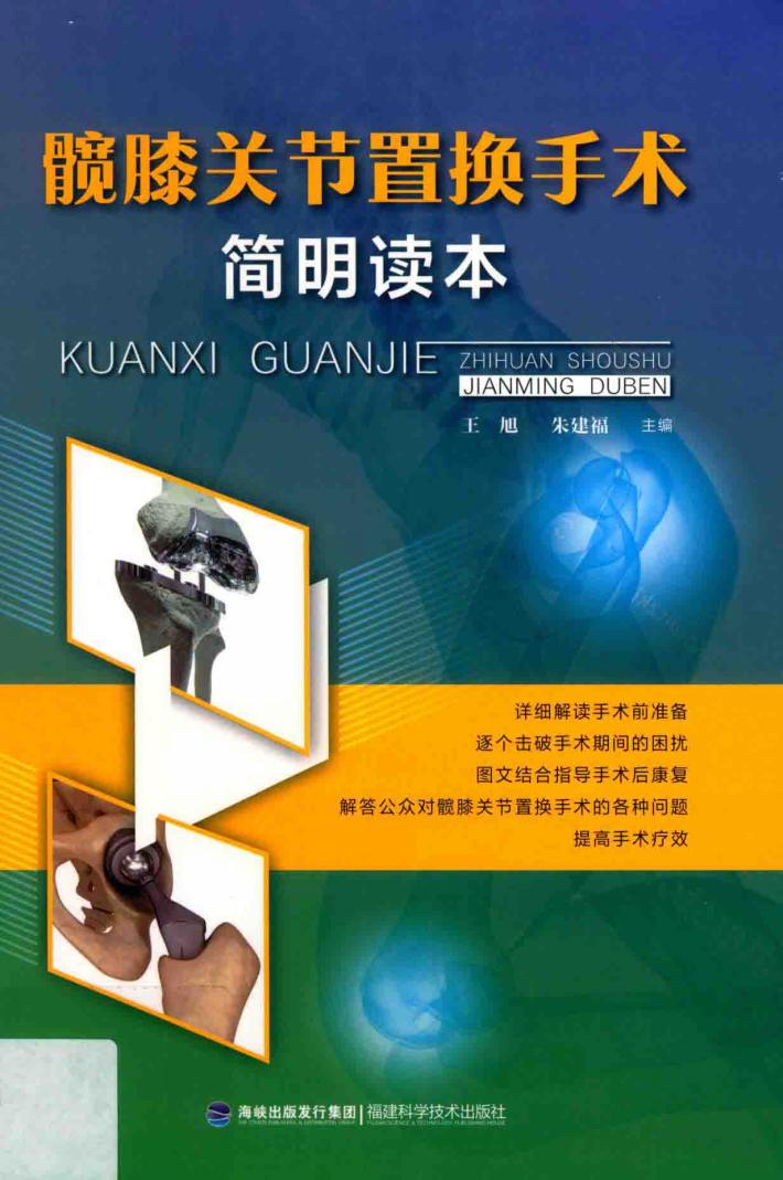 髋膝关节置换手术简明读本 封面
