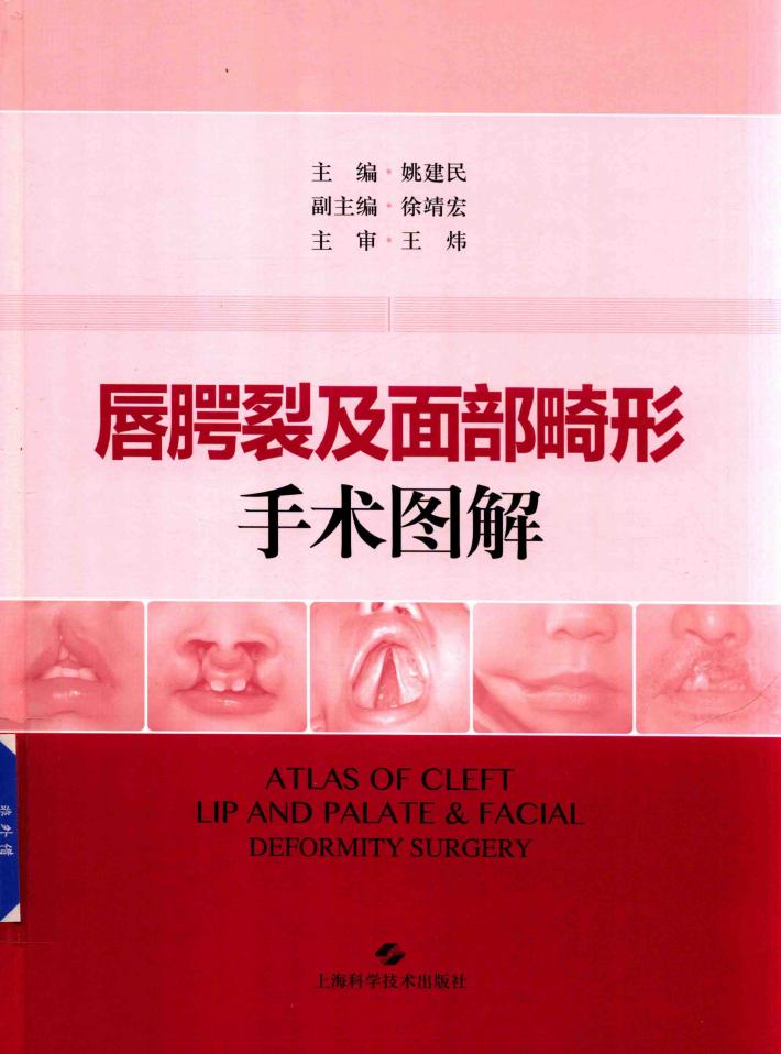 唇腭裂及面部畸形手术图解 封面