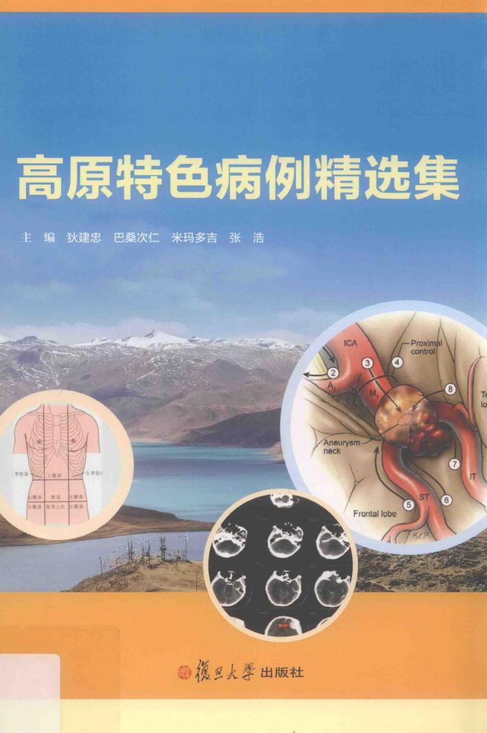 高原特色病例精选集 封面