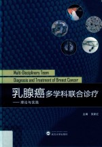 乳腺癌多学科联合诊疗 封面