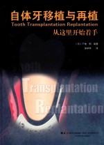 自体牙移植与再植  从这里开始着手 封面