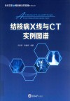 结核病X线与CT实例图谱 封面
