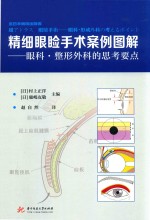 精细眼睑手术案例图解 封面