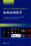 PET/CT  PET/MR与SPECT疑难病例集萃 封面