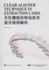 无托槽隐形矫治技术拔牙病例解析 封面