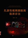 孔源性视网膜脱离临床诊治 封面