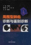 周围型肺癌诊断与鉴别诊断 封面