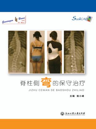 脊柱侧弯的保守治疗 封面