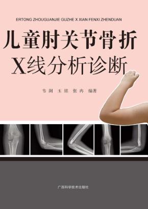 儿童肘关节骨折X线分析诊断 封面