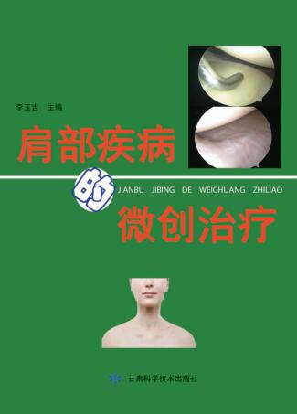 肩部疾病的微创治疗 封面