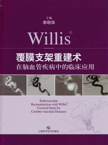 Willis覆膜支架重建术在脑血管疾病中的临床应用 封面