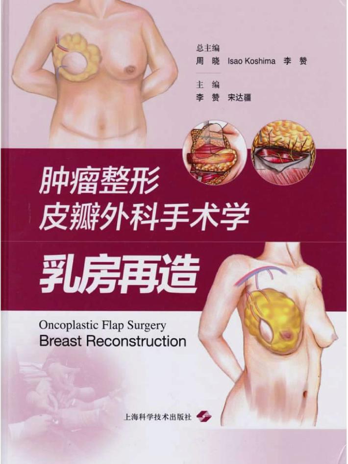 肿瘤整形皮瓣外科手术学 封面