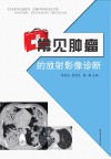 常见肿瘤的放射影像诊断 封面