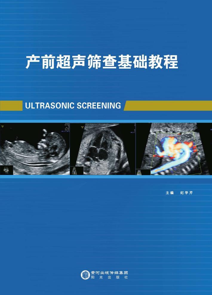 产前超声筛查基础教程 封面