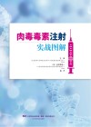 肉毒毒素注射实战图解 封面