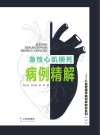 急性心肌梗死病例精解 封面