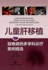 儿童肝移植  疑难病例多学科诊疗案例精选 封面