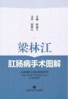 梁林江肛肠病手术图解 封面