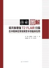 图解磁共振增强T2FLAIR扫描在中枢神经系统病变中的临床应用 封面